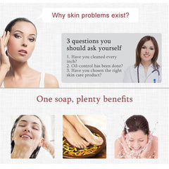 Sulfur Soap Skin Repair